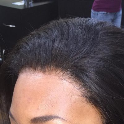 Natural-looking scalp