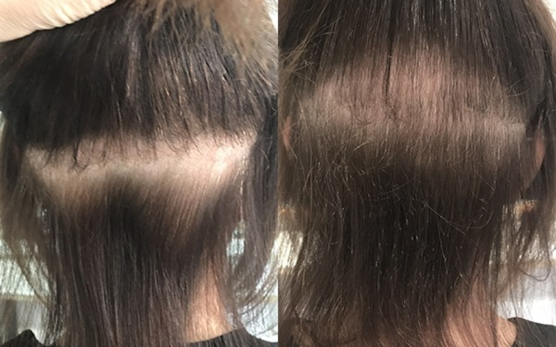 Can you become damaged by microbead hair extensions?