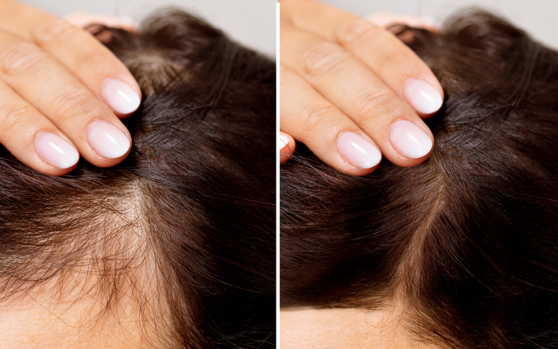 It exerts pressure on the scalp and causes discomfort